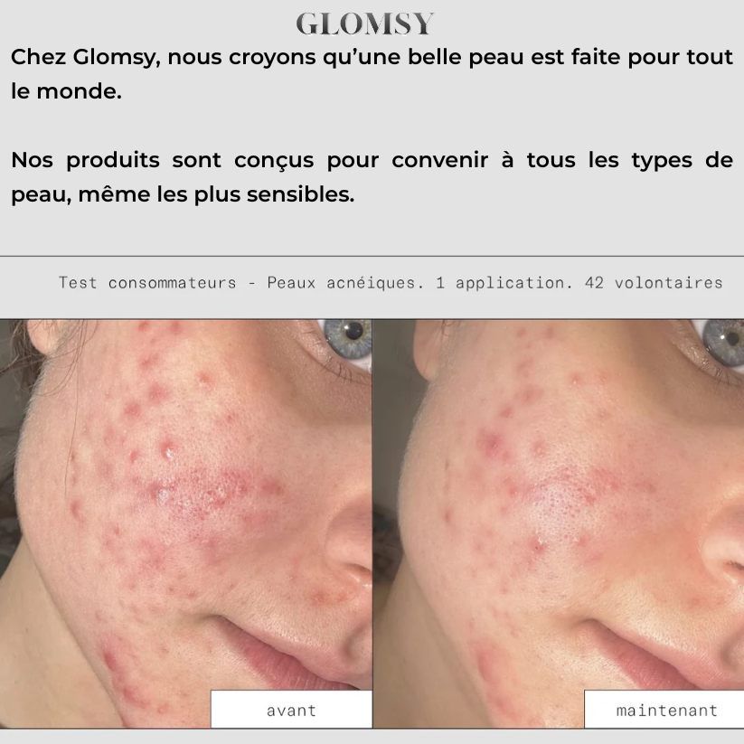 Soin Exfoliant | Solution Naturelle au Riz