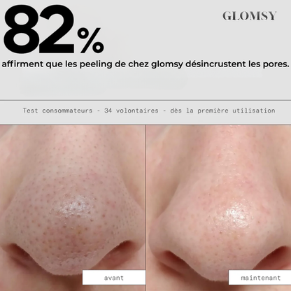 Soin Exfoliant | Solution Naturelle au Riz