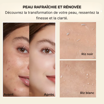 Soin Exfoliant | Solution Naturelle au Riz