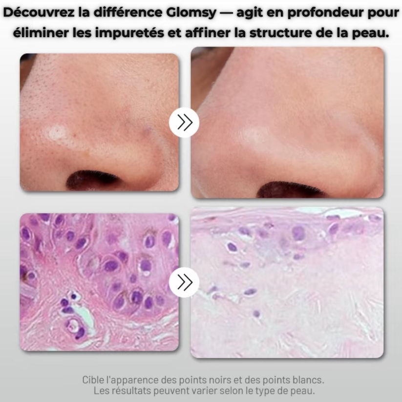 Soin Exfoliant | Solution Naturelle au Riz